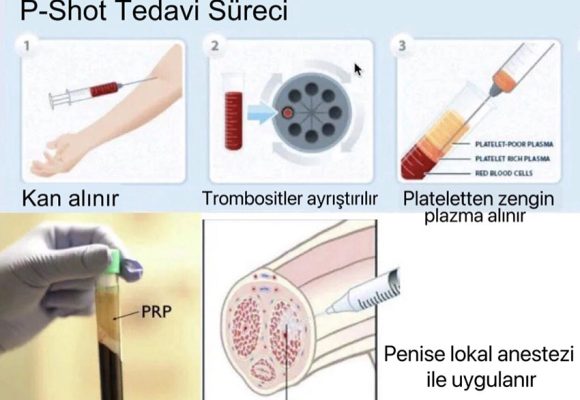 Penis Güçlendirme